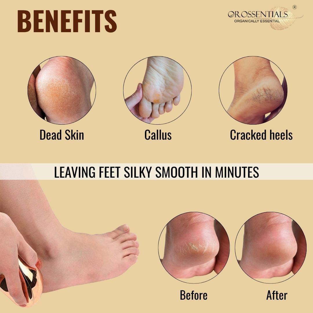 Buy Orossentials Professional Foot Scraper for Dead Skin Removal